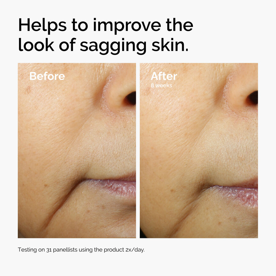 The Ordinary Caffeine 3% + Escin 1% Face Serum - Image 6