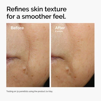 The Ordinary Caffeine 3% + Escin 1% Face Serum - Image 14