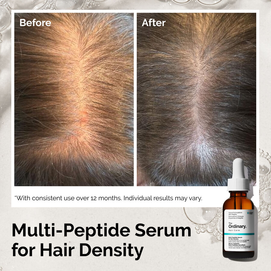 The Ordinary Multi-Peptide Serum for Hair Density - Image 5
