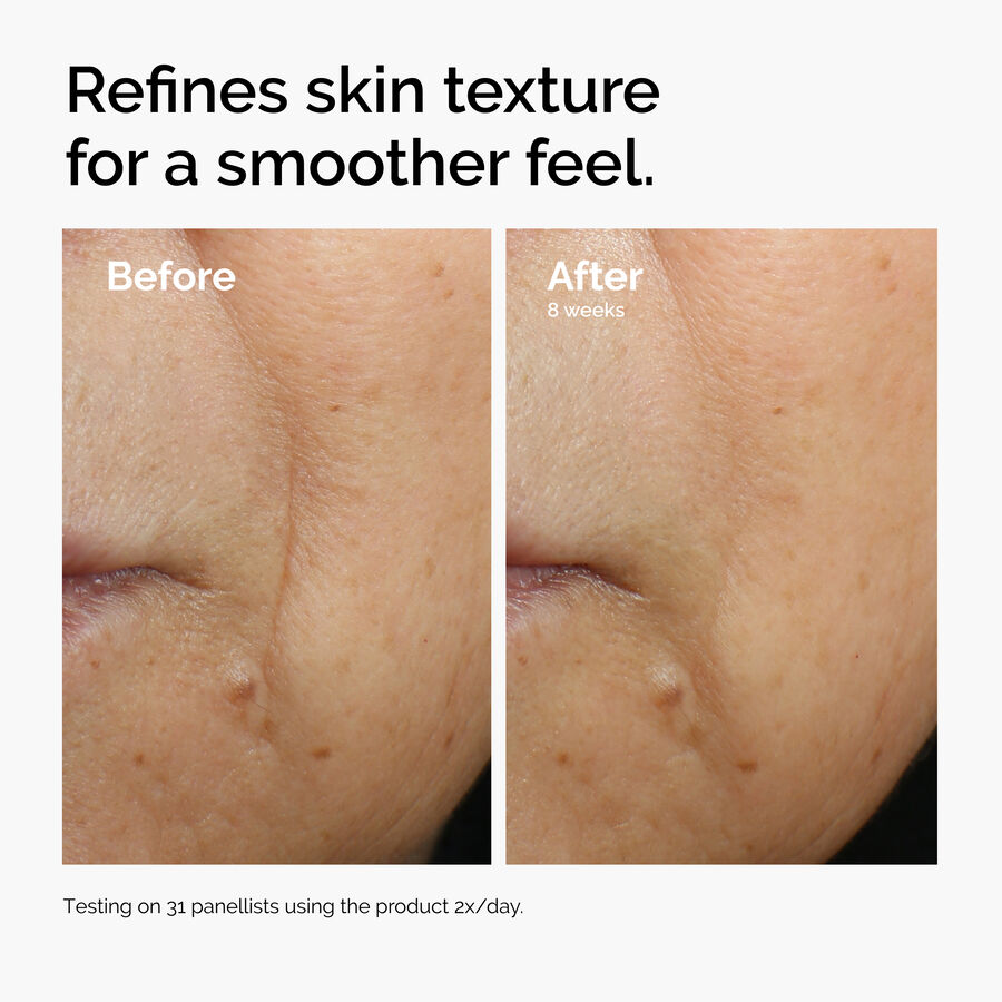 The Ordinary Caffeine 3% + Escin 1% Face Serum - Image 5